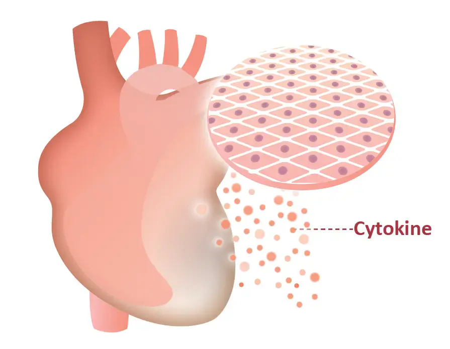 iPS Cardiac Cell Sheet Approved for Public Insurance Coverage